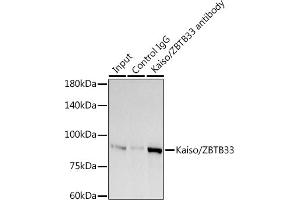 Immunoprecipitation analysis of 300 μg extracts of A-549 cells using 3 μg Kaiso/ZBTB33 antibody (ABIN7271437). (ZBTB33 anticorps)