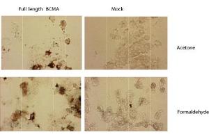 Immunostaining of HEK 293 cells transfected with a human BCMA expression plasmid (left panel), or mock transfected (right panel). (BCMA anticorps  (Extracellular Domain))