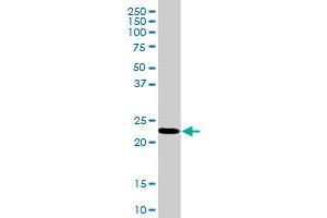 RPL18 MaxPab rabbit polyclonal antibody. (RPL18 anticorps  (AA 1-188))