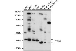 Western blot analysis of extracts of various cell lines, using OSTM1 antibody (ABIN4904622) at 1:3000 dilution. (OSTM1 anticorps)