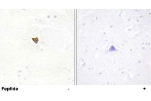 Immunohistochemistry analysis of paraffin-embedded human brain tissue using JAKMIP2 polyclonal antibody . (JAKMIP2 anticorps  (C-Term))
