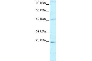 WB Suggested Anti-HMGB2 Antibody Titration:  0. (HMGB2 anticorps  (C-Term))