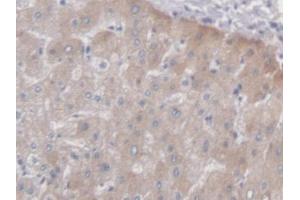 IHC-P analysis of Human Liver Tissue, with DAB staining. (PCYOX1 anticorps  (AA 174-505))