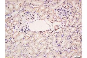Formalin-fixed and paraffin embedded rat kidney labeled with Rabbit Anti-HER4/ErbB4 Polyclonal Antibody, Unconjugated  at 1:200 followed by conjugation to the secondary antibody and DAB staining (ERBB4 anticorps  (AA 451-550))
