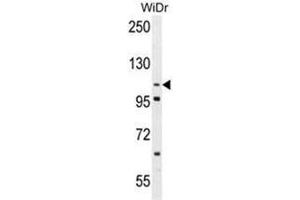 Western blot analysis of ADAM19 Antibody (Center) in WiDr cell line lysates (35 µg/lane). (ADAM19 anticorps  (Middle Region))