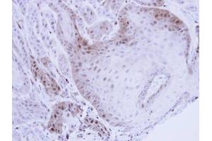IHC-P Image Immunohistochemical analysis of paraffin-embedded Cal27 Xenograft, using PSMB8, antibody at 1:100 dilution.