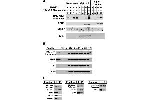 Sterol-regulated localization of HMG-CoA reductase to the buoyant, ADRP-enriched lipid droplet fraction.