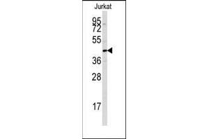 Western blot analysis of anti-PTPN7 Antibody in Jurkat cell line lysates (35ug/lane). (PTPN7 anticorps  (Ser44))