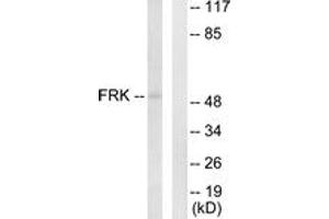 Western blot analysis of extracts from Jurkat cells, using FRK Antibody. (FRK anticorps  (AA 71-120))