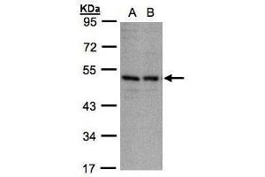 WB Image Sample(30 ug whole cell lysate) A:A431, B:H1299 10% SDS PAGE antibody diluted at 1:1000 (KIR3DL1 anticorps  (Center))
