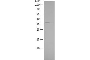 Western Blotting (WB) image for Beta-secretase 1 (BACE1) (AA 46-152) protein (His-IF2DI Tag) (ABIN7121998)