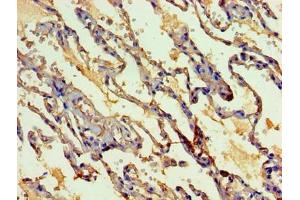 Immunohistochemistry of paraffin-embedded human lung tissue using ABIN7160405 at dilution of 1:100 (MYEF2 anticorps  (AA 372-576))