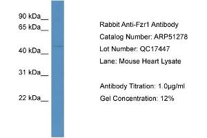 WB Suggested Anti-Fzr1  Antibody Titration: 0. (FZR1 anticorps  (N-Term))