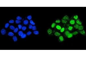 IF analysis of HOXD11 using anti-HOXD11 antibody (ABIN7603174).