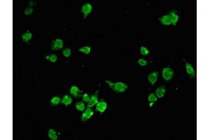 Immunofluorescent analysis of SH-SY5Y cells using ABIN7155209 at dilution of 1:100 and Alexa Fluor 488-congugated AffiniPure Goat Anti-Rabbit IgG(H+L)