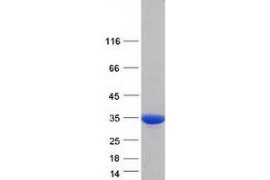 Validation with Western Blot