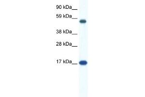 WB Suggested Anti-ZNF554 Antibody Titration:  0. (ZNF554 anticorps  (N-Term))