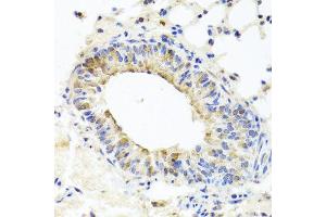 Immunohistochemistry of paraffin-embedded mouse lung using MUC16 antibody at dilution of 1:100 (x40 lens). (MUC16 anticorps)