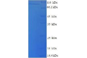 SDS-PAGE (SDS) image for Lysyl Oxidase-Like 2 (LOXL2) (AA 26-776) protein (His tag) (ABIN5709873)
