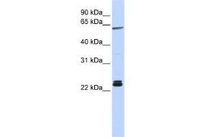 WB Suggested Anti-H1F0 Antibody Titration: 0. (Histone H1 anticorps  (N-Term))