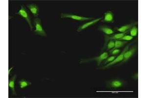 Immunofluorescence of purified MaxPab antibody to PLA2G16 on HeLa cell. (PLA2G16 anticorps  (AA 1-162))