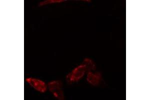 ABIN6274773 staining Hela cells by IF/ICC. (RPL23 anticorps  (C-Term))