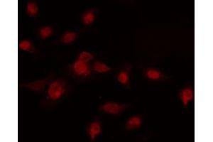 ABIN6274228 staining COLO205 cells by IF/ICC. (HOXA7 anticorps  (Internal Region))
