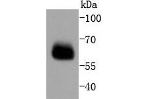 Lane 1: PC-12 lysates probed with Smad4 (3A1) Monoclonal Antibody  at 1:1000 overnight at 4˚C.