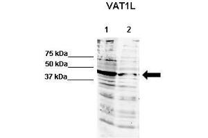 WB Suggested Anti-Vat1l Antibody  Positive Control: Lane 1: 60ug human NT2 cell line Lane 2: 80ug mouse brain extract  Primary Antibody Dilution :  1:500 Secondary Antibody : IRDye 800 CW goat anti-rabbit from Li-COR Bioscience Secondry Antibody Dilution :  1:20,000 Submitted by: Dr. (VAT1L anticorps  (N-Term))