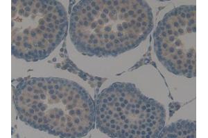 IHC-P analysis of Rat Testis Tissue, with DAB staining. (KRT15 anticorps  (AA 94-402))