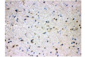 anti-Alkaline Phosphatase, Liver/bone/kidney (ALPL) (N-Term) antibody