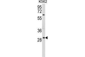 Western blot analysis of UPK1B Antibody (Center) in K562 cell line lysates (35 µg/lane). (Uroplakin 1B anticorps  (Middle Region))