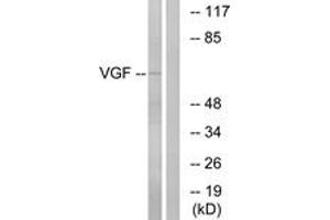 Western blot analysis of extracts from RAW264. (VGF anticorps  (AA 454-503))
