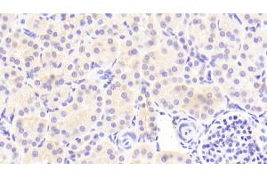 Detection of EP1 in Human Kidney Tissue using Polyclonal Antibody to Prostaglandin E Receptor 1 (EP1)