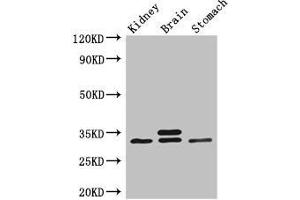 Western Blot Positive WB detected in: Mouse kidney tissue, Mouse brain tissue, Mouse stomach tissue All lanes: SCGN antibody at 3 μg/mL Secondary Goat polyclonal to rabbit IgG at 1/50000 dilution Predicted band size: 33 kDa Observed band size: 33 kDa