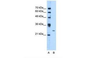 Image no. 1 for anti-Transmembrane Protein 126B (TMEM126B) (AA 141-190) antibody (ABIN321580) (TMEM126B anticorps  (AA 141-190))