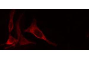 ABIN6274660 staining Hela cells by IF/ICC.
