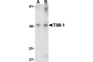 Western blot analysis of TIM-1 in human uterus tissue lysate with this product at (A) 1 and (B) 2 μg/ml. (HAVCR1 anticorps  (Center))
