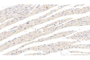 anti-Corticotropin Releasing Hormone Binding Protein (CRHBP) (AA 25-322) antibody