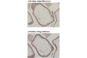 Immunohistochemistry (IHC) image for anti-CD274 (PD-L1) (Extracellular Domain) antibody (ABIN1449244) (PD-L1 anticorps  (Extracellular Domain))