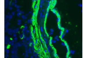 Image no. 3 for anti-Actin, alpha 2, Smooth Muscle, Aorta (ACTA2) antibody (ABIN335372)