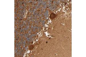 Immunohistochemical staining (Formalin-fixed paraffin-embedded sections) of human cerebellum with IQCJ-SCHIP1 polyclonal antibody  shows strong cytoplasmic positivity in Purkinje cells at 1:20-1:50 dilution.