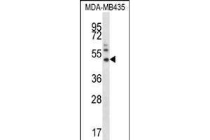 P16 Antibody  (ABIN390140 and ABIN2840644) western blot analysis in MDA-M cell line lysates (35 μg/lane). (MMP16 anticorps  (N-Term))
