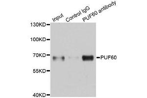 Immunoprecipitation analysis of 150ug extracts of A549 cells using 3ug PUF60 antibody.