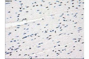 Image no. 5 for anti-Fc gamma RII (CD32) antibody (ABIN1497256) (Fc gamma RII (CD32) anticorps)