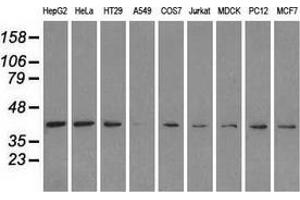 Western blot analysis of extracts (35 µg) from 9 different cell lines by using anti-MAPK1 monoclonal antibody. (ERK2 anticorps)