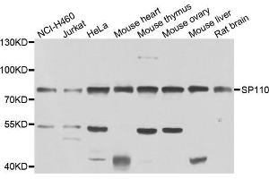 Western blot analysis of extracts of various cell lines, using SP110 antibody (ABIN5975571) at 1/1000 dilution. (SP110 anticorps)