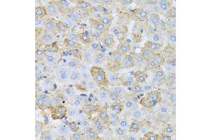 Immunohistochemistry of paraffin-embedded rat liver using APOC1 antibody (ABIN5973281) at dilution of 1/100 (40x lens). (APOC1 anticorps)