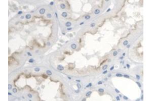 DAB staining on IHC-P; Samples: Human Kidney Tissue (TBXA2R anticorps  (AA 3-324))