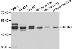 Western blot analysis of extracts of various cell lines, using AP1M2 antibody. (AP1m2 anticorps)